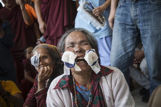 Fred Hollows Foundation cataract patient laughing with gauze unpeeled from her eyes